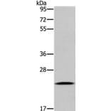UBE2S Antibody from Signalway Antibody (36429) - Antibodies.com