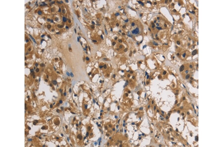 Immunohistochemistry - UBE2S Antibody from Signalway Antibody (36429) - Antibodies.com