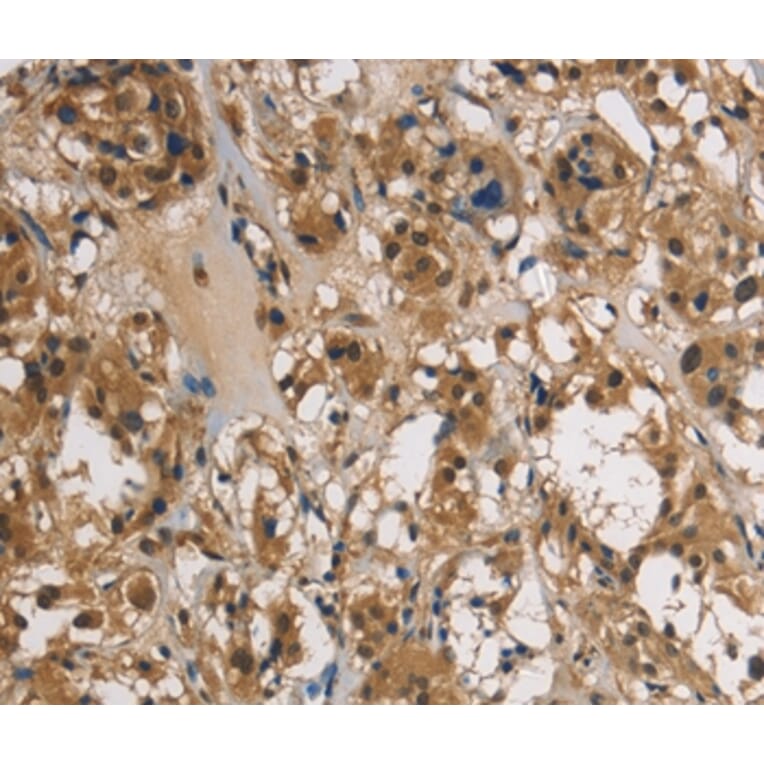 Immunohistochemistry - UBE2S Antibody from Signalway Antibody (36429) - Antibodies.com