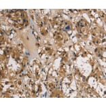 Immunohistochemistry - UBE2S Antibody from Signalway Antibody (36429) - Antibodies.com