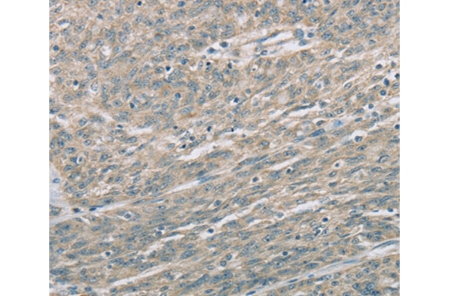 Immunohistochemistry - EDA2R Antibody from Signalway Antibody (36434) - Antibodies.com