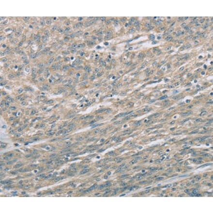 Immunohistochemistry - EDA2R Antibody from Signalway Antibody (36434) - Antibodies.com