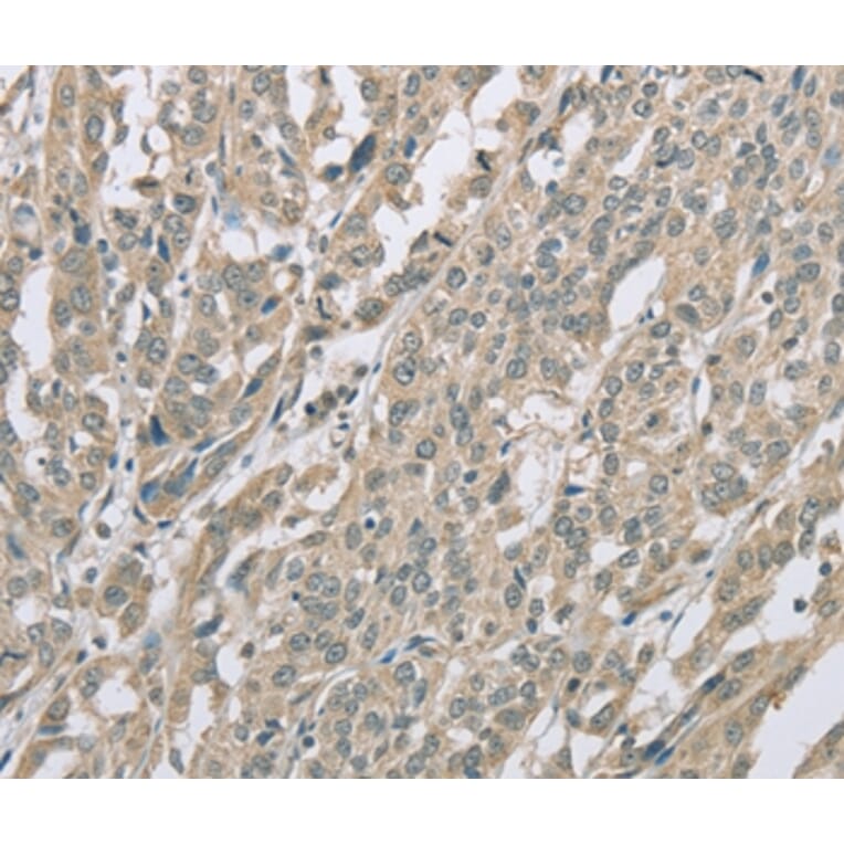 Immunohistochemistry - EDA2R Antibody from Signalway Antibody (36434) - Antibodies.com