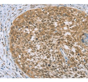 Immunohistochemistry - EDIL3 Antibody from Signalway Antibody (36435) - Antibodies.com