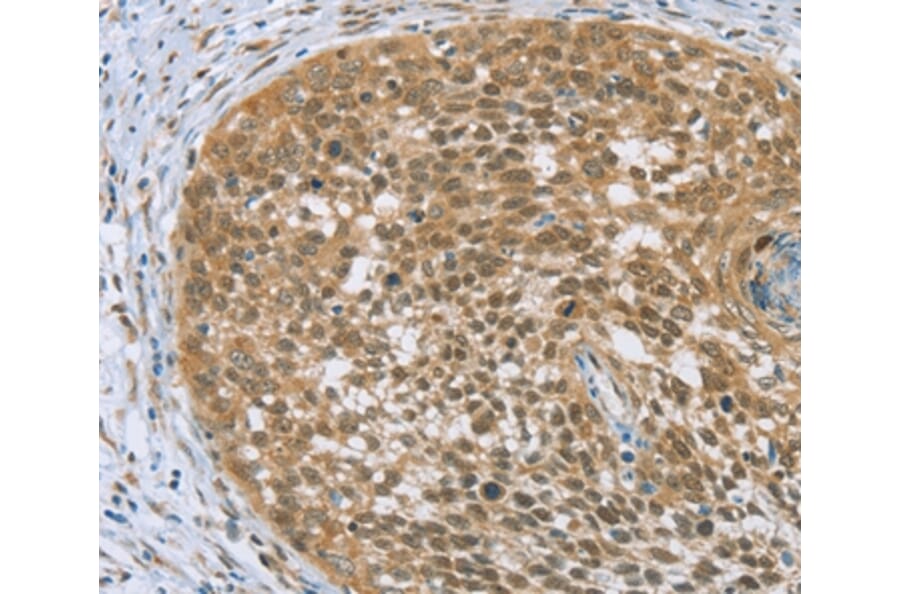 Immunohistochemistry - EDIL3 Antibody from Signalway Antibody (36435) - Antibodies.com