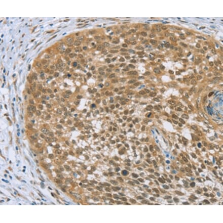 Immunohistochemistry - EDIL3 Antibody from Signalway Antibody (36435) - Antibodies.com