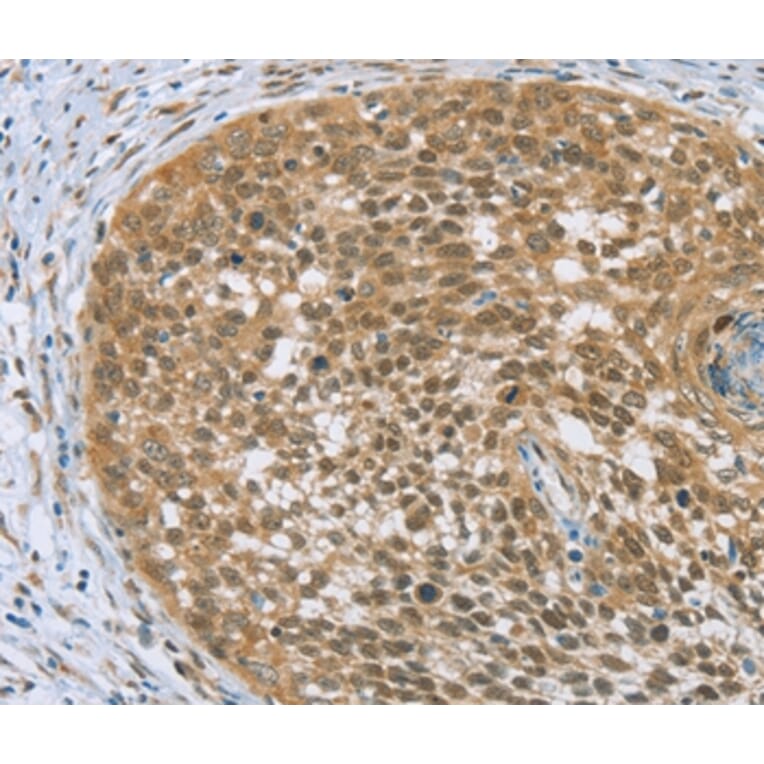 Immunohistochemistry - EDIL3 Antibody from Signalway Antibody (36435) - Antibodies.com