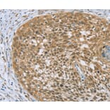 Immunohistochemistry - EDIL3 Antibody from Signalway Antibody (36435) - Antibodies.com