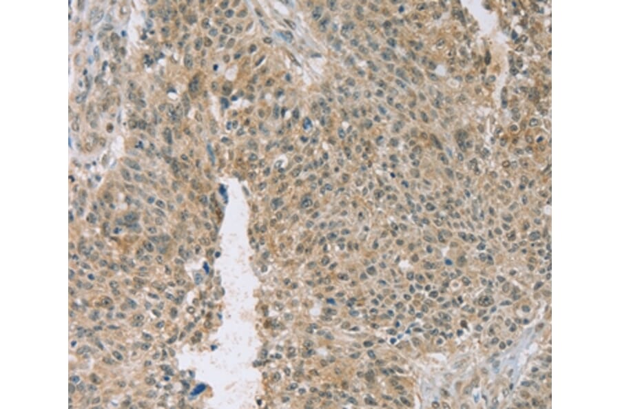 Immunohistochemistry - EDIL3 Antibody from Signalway Antibody (36435) - Antibodies.com