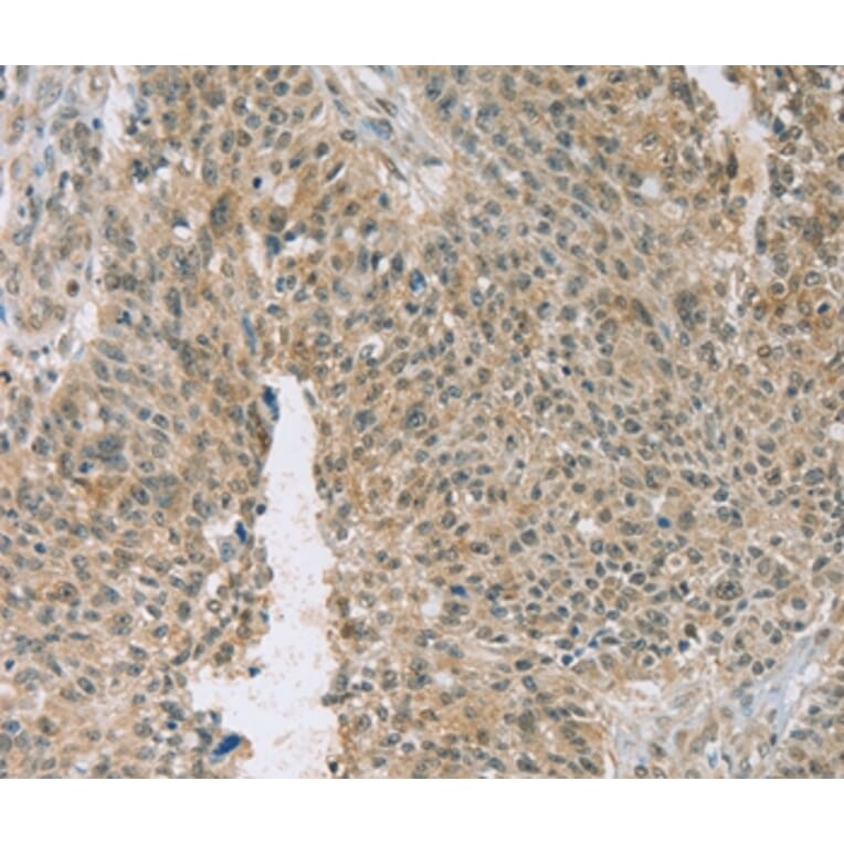 Immunohistochemistry - EDIL3 Antibody from Signalway Antibody (36435) - Antibodies.com