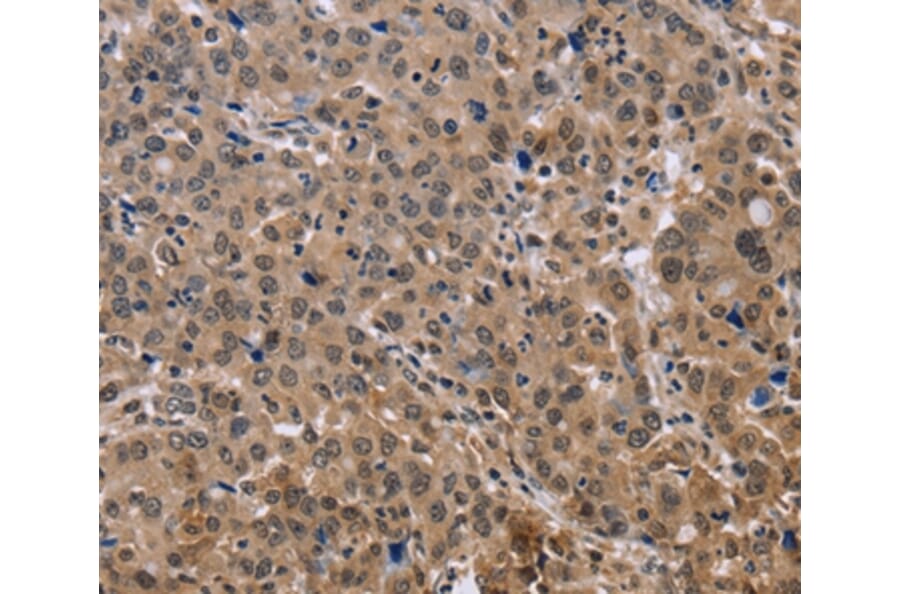 Immunohistochemistry - KIF25 Antibody from Signalway Antibody (36442) - Antibodies.com