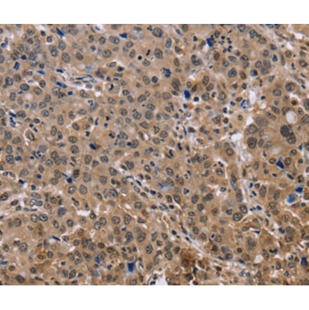 Immunohistochemistry - KIF25 Antibody from Signalway Antibody (36442) - Antibodies.com