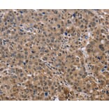 Immunohistochemistry - KIF25 Antibody from Signalway Antibody (36442) - Antibodies.com