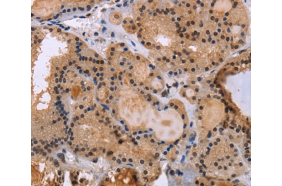 Immunohistochemistry - KIF25 Antibody from Signalway Antibody (36442) - Antibodies.com