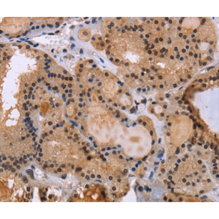 Immunohistochemistry - KIF25 Antibody from Signalway Antibody (36442) - Antibodies.com