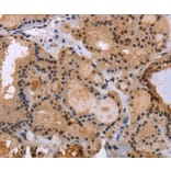 Immunohistochemistry - KIF25 Antibody from Signalway Antibody (36442) - Antibodies.com