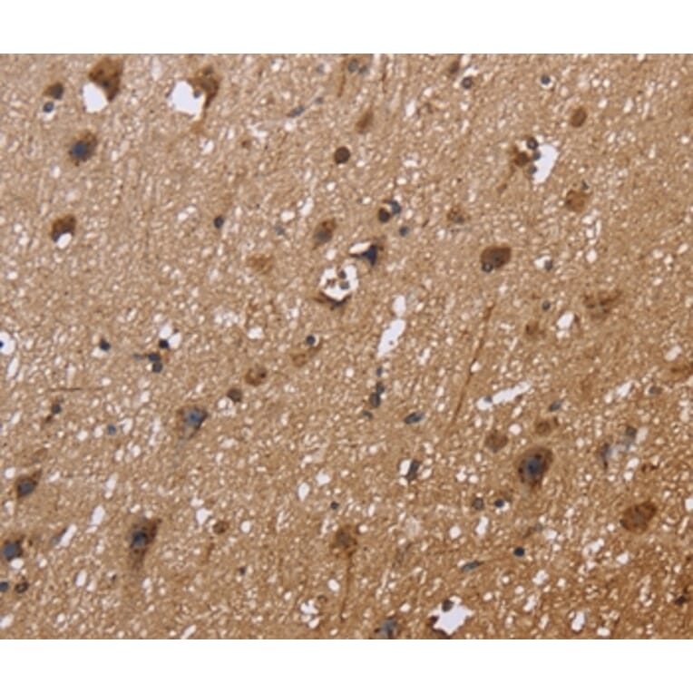 Immunohistochemistry - EXTL3 Antibody from Signalway Antibody (36453) - Antibodies.com