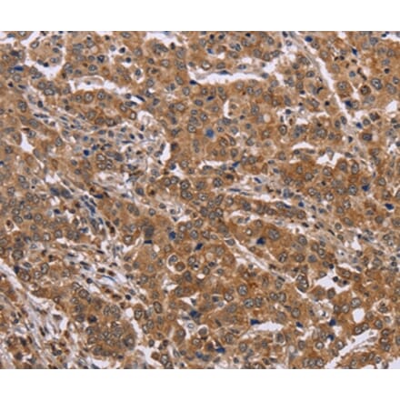 Immunohistochemistry - FAAH2 Antibody from Signalway Antibody (36455) - Antibodies.com