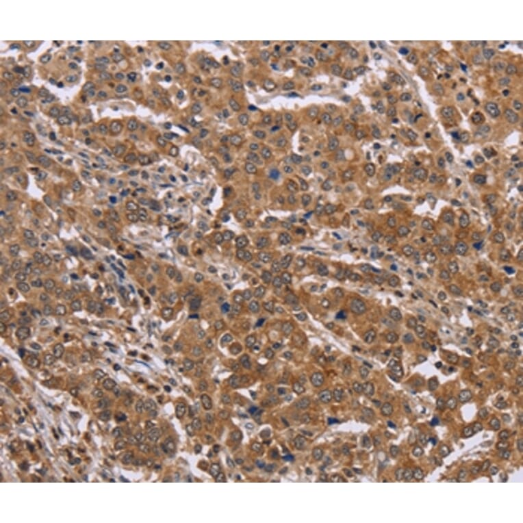 Immunohistochemistry - FAAH2 Antibody from Signalway Antibody (36455) - Antibodies.com