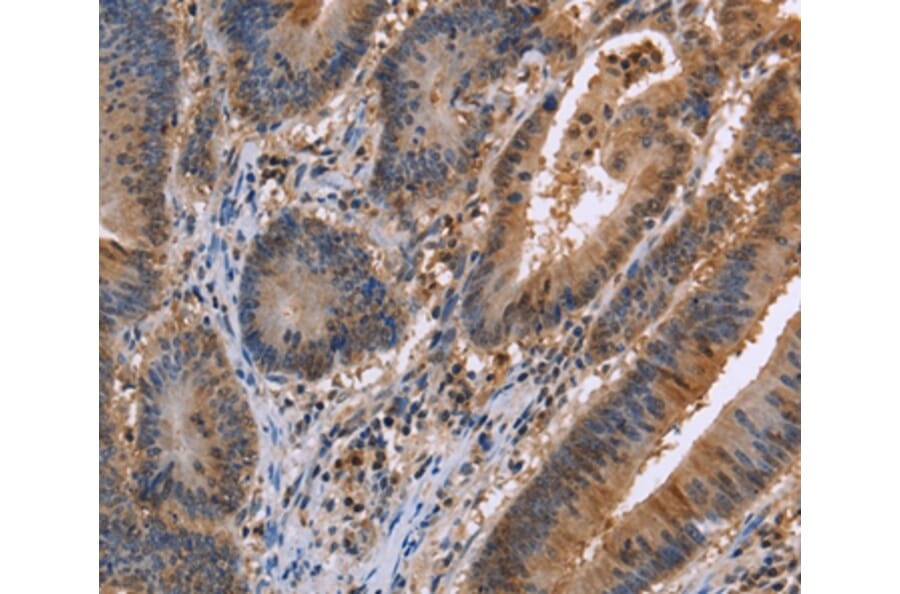 Immunohistochemistry - FAAH2 Antibody from Signalway Antibody (36455) - Antibodies.com