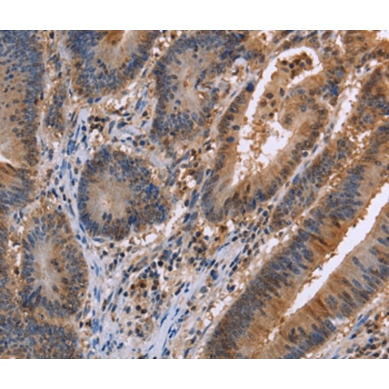 Immunohistochemistry - FAAH2 Antibody from Signalway Antibody (36455) - Antibodies.com