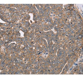 Immunohistochemistry - FAIM2 Antibody from Signalway Antibody (36459) - Antibodies.com