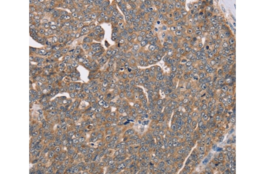 Immunohistochemistry - FAIM2 Antibody from Signalway Antibody (36459) - Antibodies.com
