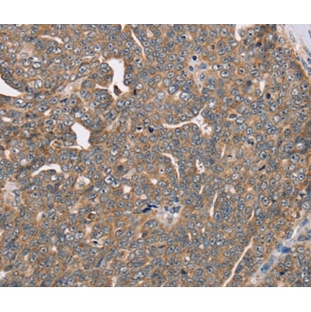 Immunohistochemistry - FAIM2 Antibody from Signalway Antibody (36459) - Antibodies.com