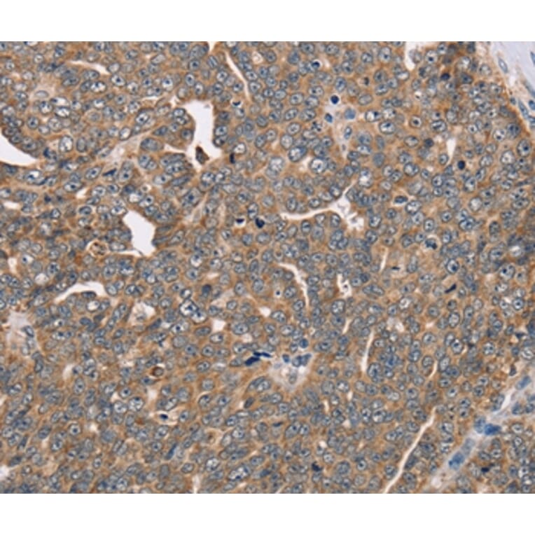 Immunohistochemistry - FAIM2 Antibody from Signalway Antibody (36459) - Antibodies.com