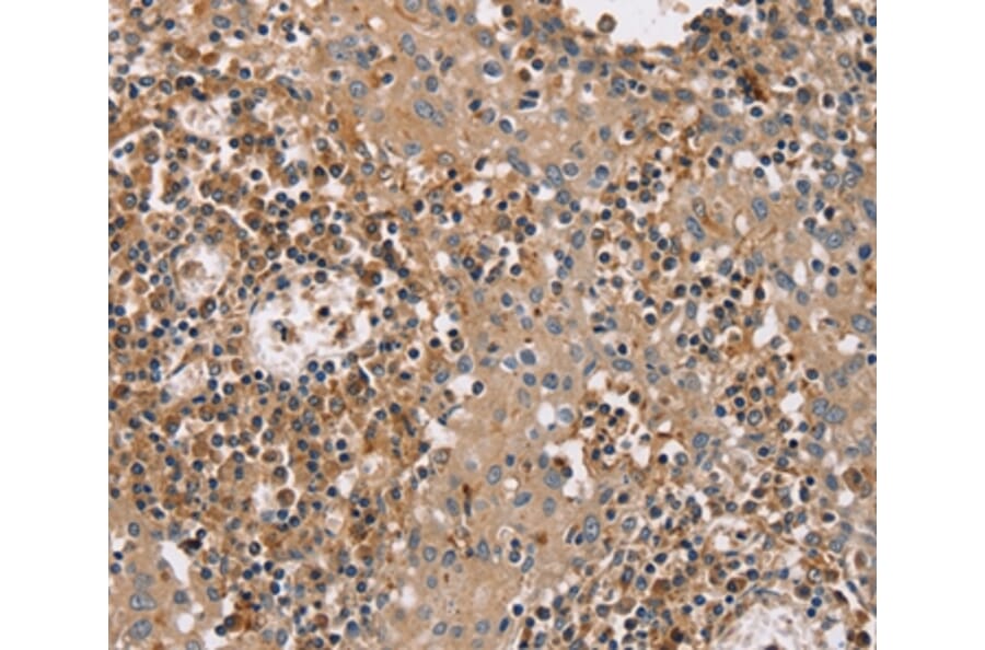 Immunohistochemistry - FAIM2 Antibody from Signalway Antibody (36459) - Antibodies.com