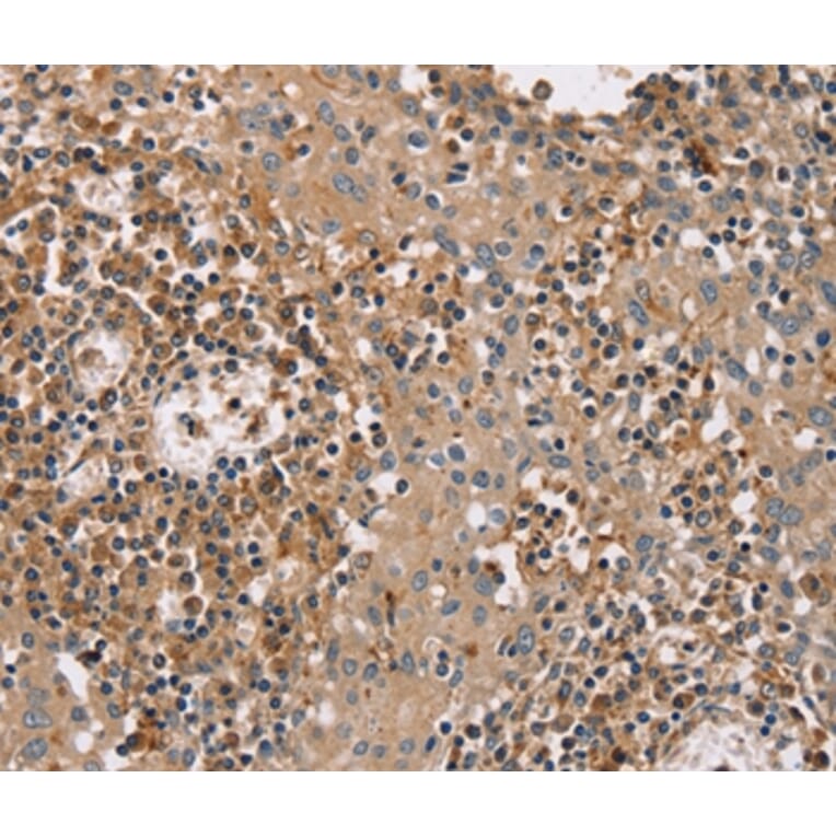 Immunohistochemistry - FAIM2 Antibody from Signalway Antibody (36459) - Antibodies.com