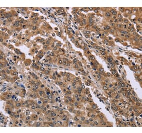 Immunohistochemistry - FAM3B Antibody from Signalway Antibody (36462) - Antibodies.com