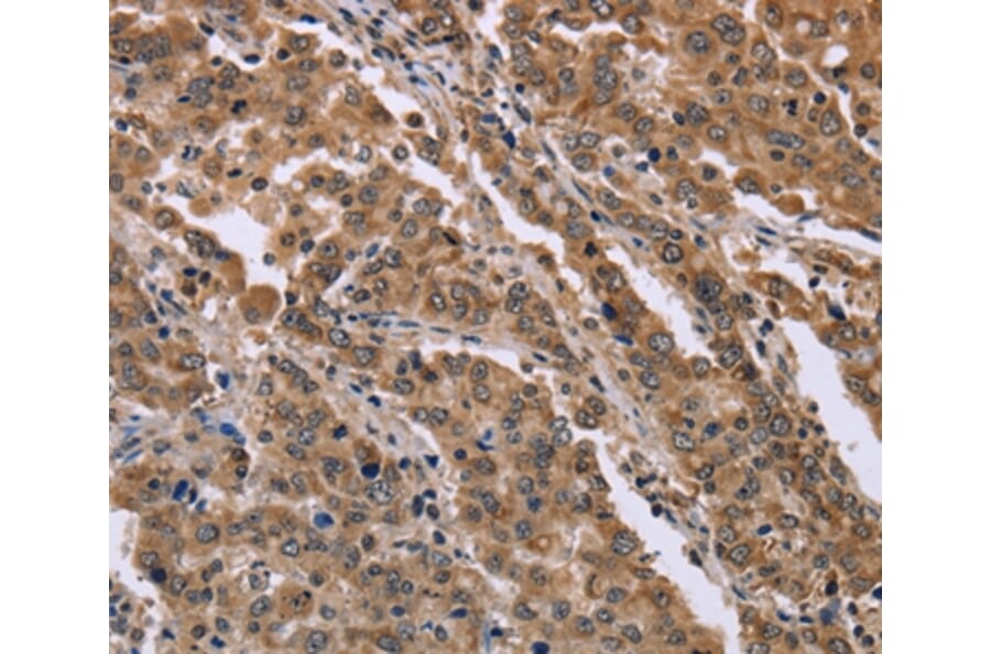 Immunohistochemistry - FAM3B Antibody from Signalway Antibody (36462) - Antibodies.com