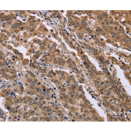 Immunohistochemistry - FAM3B Antibody from Signalway Antibody (36462) - Antibodies.com