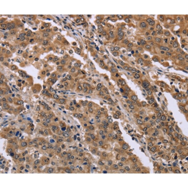 Immunohistochemistry - FAM3B Antibody from Signalway Antibody (36462) - Antibodies.com