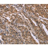 Immunohistochemistry - FAM3B Antibody from Signalway Antibody (36462) - Antibodies.com