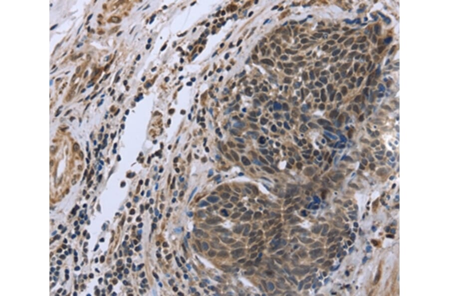 Immunohistochemistry - FANCG Antibody from Signalway Antibody (36464) - Antibodies.com
