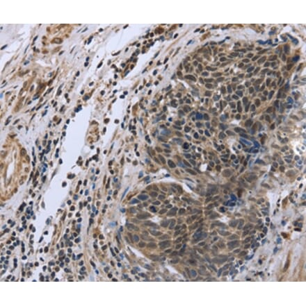 Immunohistochemistry - FANCG Antibody from Signalway Antibody (36464) - Antibodies.com