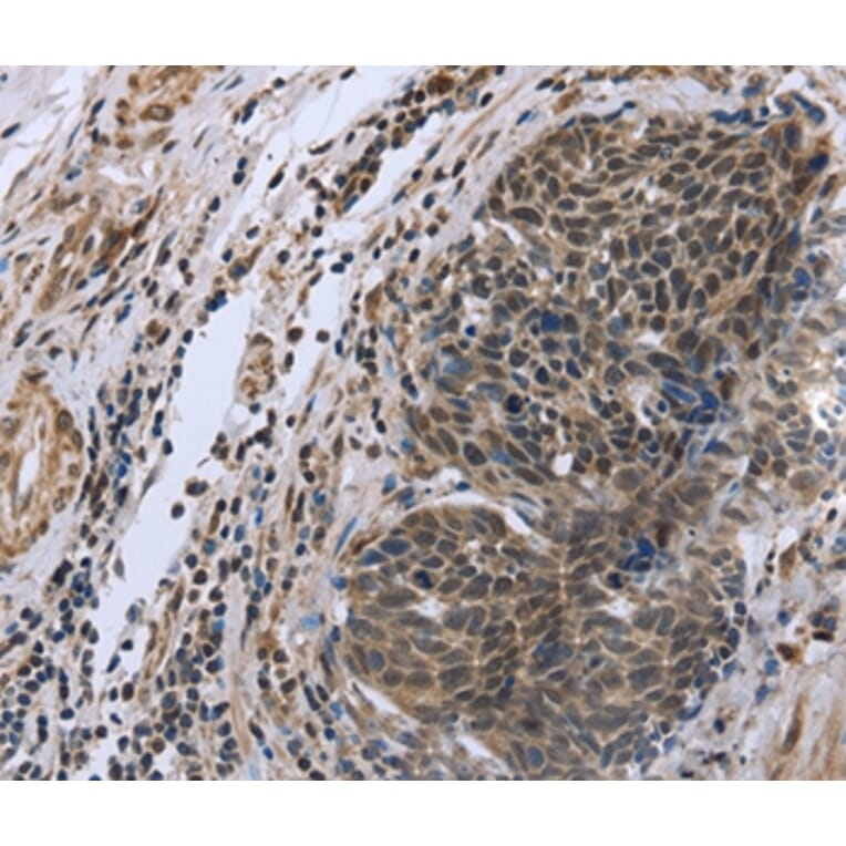 Immunohistochemistry - FANCG Antibody from Signalway Antibody (36464) - Antibodies.com
