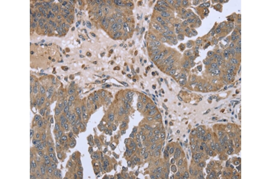 Immunohistochemistry - FANCG Antibody from Signalway Antibody (36464) - Antibodies.com