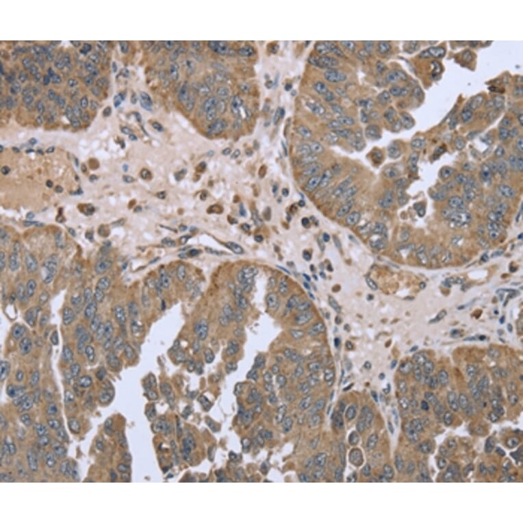 Immunohistochemistry - FANCG Antibody from Signalway Antibody (36464) - Antibodies.com