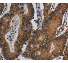 Immunohistochemistry - FGF18 Antibody from Signalway Antibody (36477) - Antibodies.com