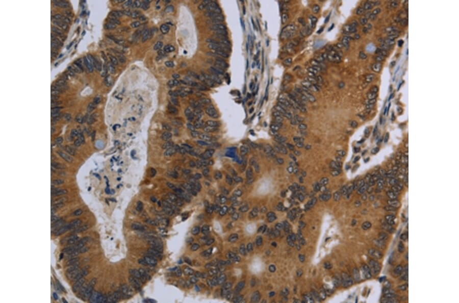 Immunohistochemistry - FGF18 Antibody from Signalway Antibody (36477) - Antibodies.com