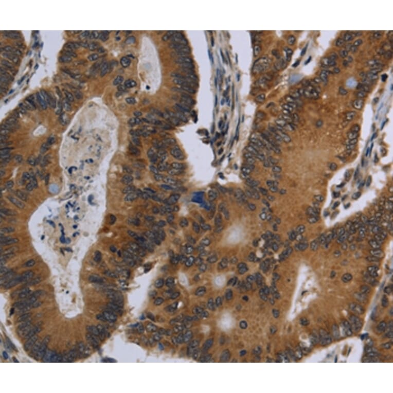 Immunohistochemistry - FGF18 Antibody from Signalway Antibody (36477) - Antibodies.com