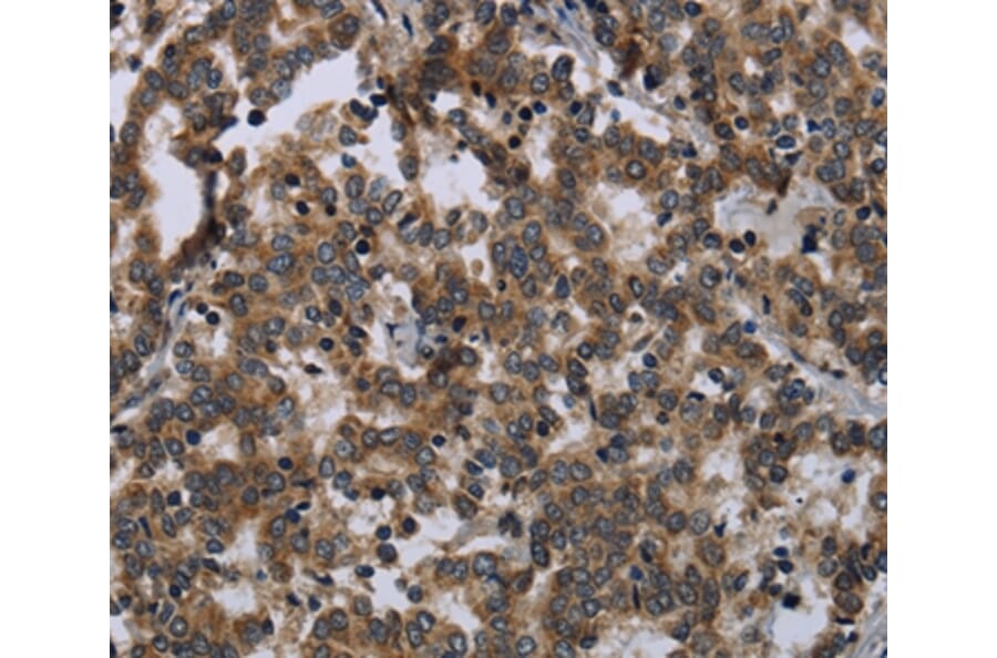 Immunohistochemistry - FGF18 Antibody from Signalway Antibody (36477) - Antibodies.com