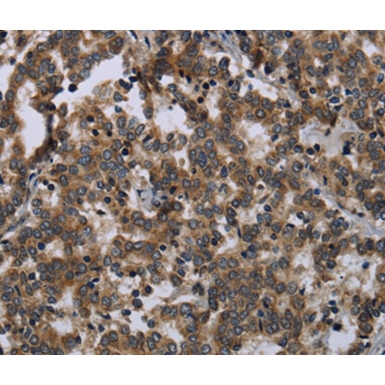 Immunohistochemistry - FGF18 Antibody from Signalway Antibody (36477) - Antibodies.com