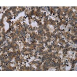 Immunohistochemistry - FGF18 Antibody from Signalway Antibody (36477) - Antibodies.com