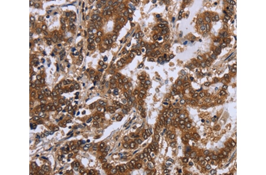 Immunohistochemistry - FGF21 Antibody from Signalway Antibody (36478) - Antibodies.com