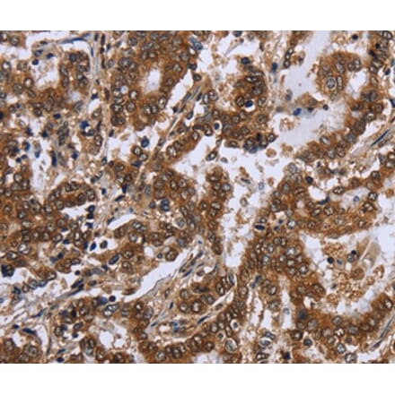 Immunohistochemistry - FGF21 Antibody from Signalway Antibody (36478) - Antibodies.com