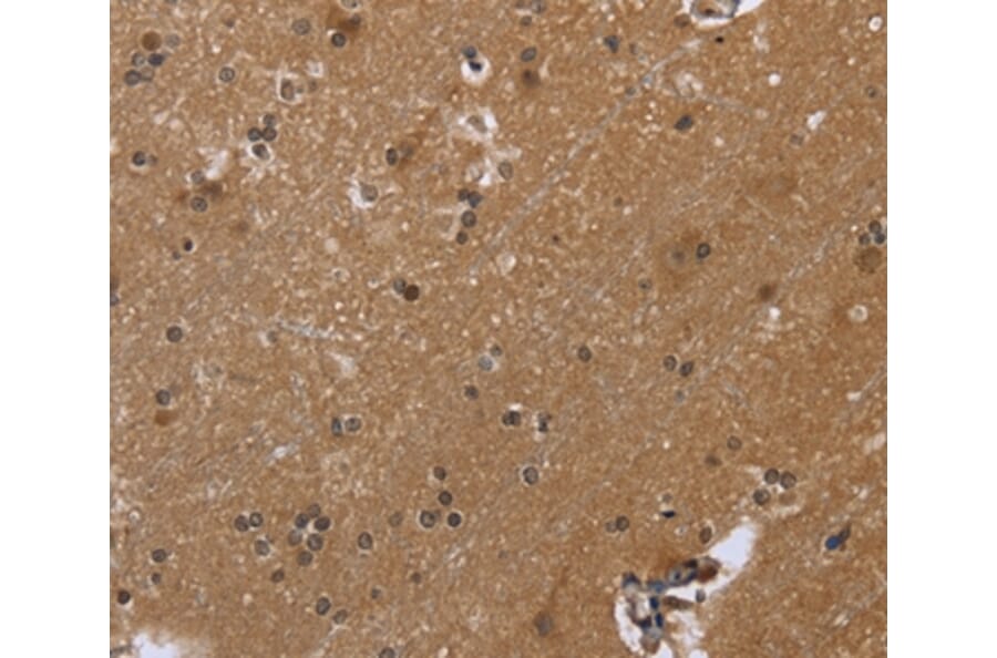 Immunohistochemistry - FGF21 Antibody from Signalway Antibody (36478) - Antibodies.com
